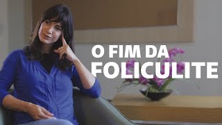 3 dicas infalíveis para evitar a foliculite  Viver Bem [upl. by Atin]