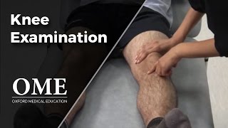 Knee Examination  Orthopaedics [upl. by Siri604]