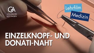 Einzelknopf und DonatiNaht [upl. by Shipp]