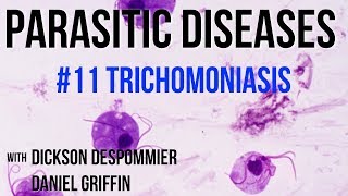 Parasitic Diseases Lectures 11 Trichomoniasis [upl. by Adon283]