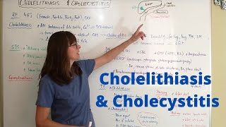 Cholelithiasis amp Cholecystitis [upl. by Lazarus]